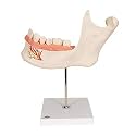 3B Scientific D25 6 Part Half Lower Jaw Model, 3 Times Full-Size, 13.8" x 7.1" x 14.2"