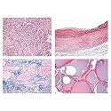 3B Scientific GmbH W13311 Human Pathology-German