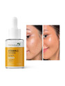 7days natural Vitamin C + E Face Serum For Brightening Skin | Niacinamide Acid | Fades Dark Spots | Acne Pimple | pigmentation Scar Marks Removals