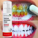 7 Days Teeth Whitening Foam to Ultra-fine YELLOW TEETH Deeply Intensive Stain Removal Teeth Whitening Liquid (50 ml)