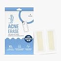 BAKE 2% Salicylic Acid Hydrocolloid Acne Absorbing (4 Patches) Surface Patch XL Pimple Patches for Blackheads Removal | Large Acne Erase Strips | Pore Cleansing &amp; Reduces Whiteheads (4 Strips)