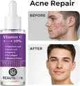 beautiloon Vitamin C 10 Percent Face Glow