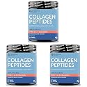 Carbamide Forte Hydrolyzed Collagen Powder | Type 1 &amp; 3 Collagen Peptides Powder for Glowing Skin &amp; Hair - Unflavored - Collagen Supplements for Women &amp; Men - 200g (Pack of 2)