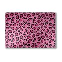 Carbon Fiber Laptop Skin Compatible with Surface Laptop 7 15" (2024) - Pink Leopard - Premium 3M Vinyl Protective Wrap Decal Cover - Easy to Apply | Crafted in The USA by MightySkins