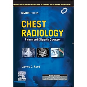 chest radiology patterns and differential diagnoses sae -7e