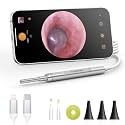 Digital Otoscope Compatible with iPhone & Android, Video Ear Scope Camera