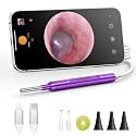 Digital Otoscope Compatible with iPhone & Android, Video Ear Scope Camera