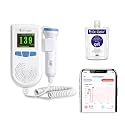 Dr. Odin OAD51B Fetal Doppler with Smart App Connectivity, Large Color LCD Display, Rechargeable Battery, Built-in Speaker, 2.5MHz Probe for FHR Monitoring, 50–240 BPM Range