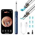 Ear Cleaner Tweezers with 6 Ear Spoon, Earwax Removal Kit with Light, Ear Cleaning kit for iOS & Android, Blue