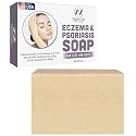 Eczema Soap Bar for Face and Body – All Natural Dermatitis, Psoriasis Treatment for Dry Itchy Flaky Skin Relief – Gentle Detoxifying, Healing, Anti-Itch, Cleansing Skincare Remedy – Eczema Soap Bar
