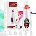 4-in-1 Blackhead Remover Vacuum – Electric Pore Cleaner with Adjustable Suction & Interchangeable Heads - Facial Device for Men & Women (White)