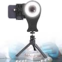 ERICAT Dental Photography Fill Light, Professional Fill Light Aid with 3 Mouth Opener and Tripod, 3 Color Temperature Adjustment & 3800K-6200K Color Temperature Range, Suit for Dentist, Clinics
