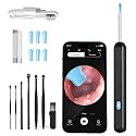 Cleansify Ear Endoscope Otoscope/Wax Cleaner with 1080p FHD Camera with Ultra fine 4.5mm Lens for Kids &amp; Adults(Black)