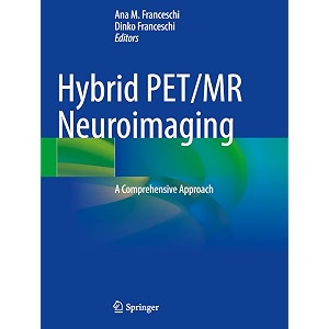 hybrid petmr neuroimaging a comprehensive approach