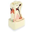 iDENTical Dental Model for 4X Pathologies of Tooth M4015 | Educational Tool for Dental Students & Professionals | Accurate Anatomy & Detailed Representation of Common Dental Pathologies