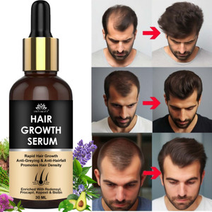 intimify hair growth serum  helps reduce fizz  adds shine  for women  men 30 ml