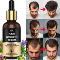 INTIMIFY Hair Growth Serum | Helps Reduce Fizz & Adds Shine | For Women & Men (30 ml)