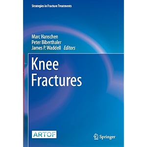 knee fractures strategies in fracture treatments