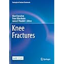 Knee Fractures (Strategies in Fracture Treatments)