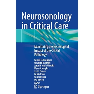 neurosonology in critical care monitoring the neurological impact of the critical pathology