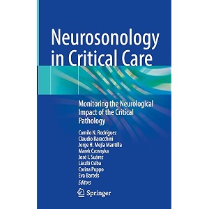 neurosonology in critical care monitoring the neurological impact of the critical pathology