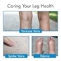 Never Quit Medical Compression Stockings for Varicose Vein ! With Graduated Compression (Small, Beige)
