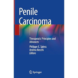 penile carcinoma therapeutic principles and advances