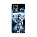 Printed Hard Back Cover Case for Xiaomi