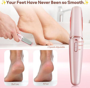 purelycart flawless pedi electronic tool file and callus remover pedicure foot roller