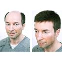 Ritzkart Hair Toupee/wig for Covering Bald Area Straight Black Hair Normal Base Human Hair Monofilament Regular Mens Hair Patch, Black,