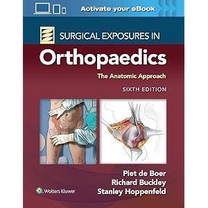surgical exposures in orthopaedics the anatomic approach