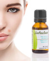 Telebrands HBN Herbaclear No Marks No Scars Natural Skin Tags and Warts Remover (15 ml)