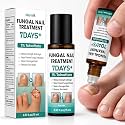 Toenail Fungus Treatment Extra Strength - 1% Tolnaftate, Fast-Acting Antifungal for Thick, Discolored & Brittle Nails, Plant-Based Gentle Formula, Repairs Damaged Toenails, 0.51 fl.oz