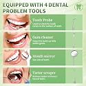 Tooth Repair Kit, Moldable Tooth Filling Repair Kit, Fake Teeth DIY at Home