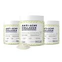 What's Up Wellness Anti-Acne Collagen|Certified Marine Titagen Collagen with Mangosteen &amp; Biotin|Reduces Adult Acne|For Men &amp; Women|Mixed Fruit|Pack of 3, powder, 3 count, 25 Servings