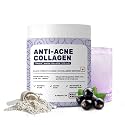 What's Up Wellness Anti-Acne Collagen|Certified Marine Titagen Collagen with Mangosteen &amp; Biotin|Reduces Adult Acne|For Men &amp; Women|Black Currant, powder, 1 count, 25 Servings