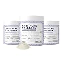 What's Up Wellness Anti-Acne Collagen|Certified Marine Titagen Collagen with Mangosteen &amp; Biotin|Reduces Adult Acne|For Men &amp; Women|Black Currant|pack of 3, powder, 3 count, 25 Servings