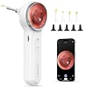 Wireless Digital Otoscope with Built-in Screen and Lights for Home Use