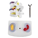 YUYTE Human Spine Model, Human Anatomical Lumbar Disc Herniation Model Human Spine School Training Supplies Excellent Way for Demonstrating Disc, The Details of The Human Spine